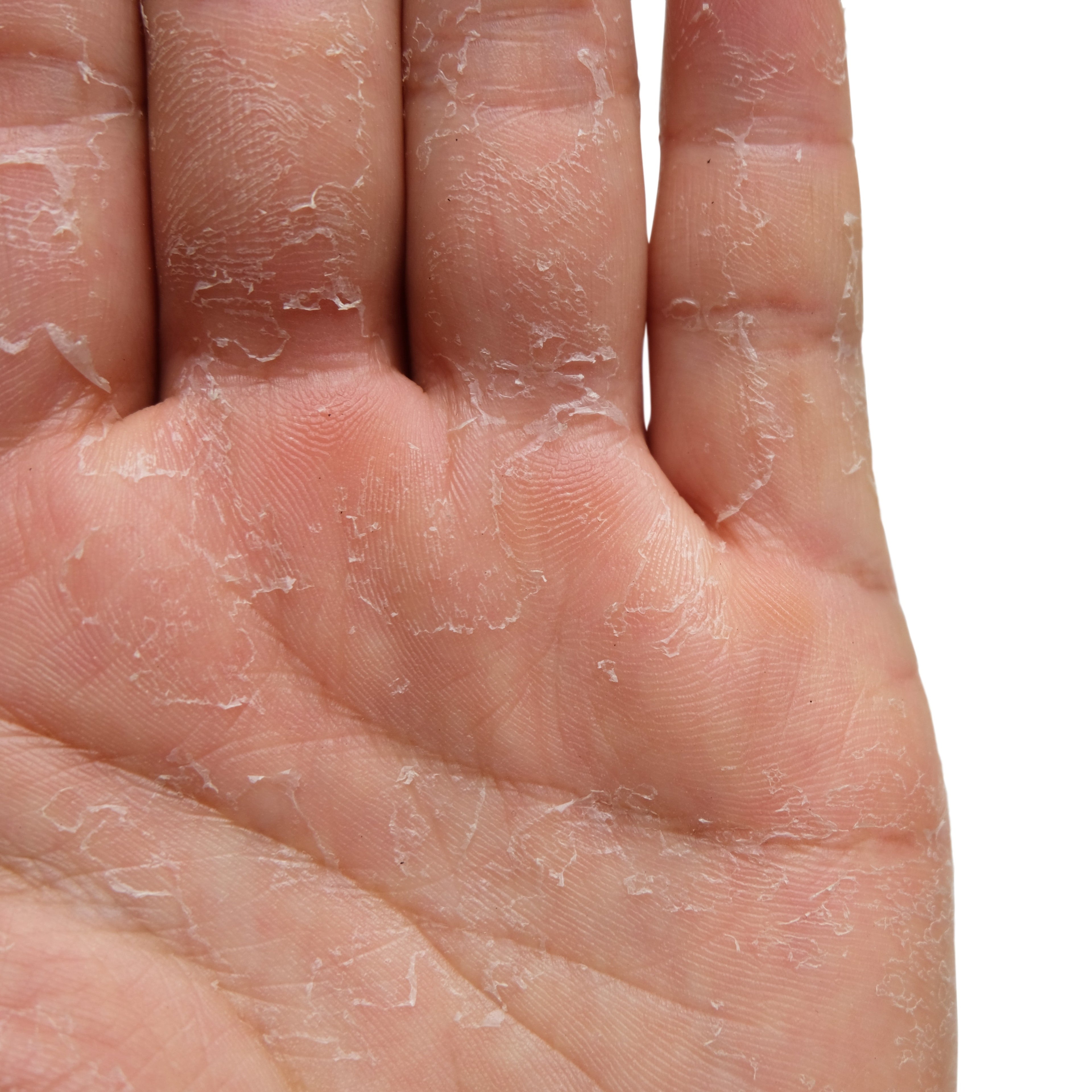 Skin Moisturizer