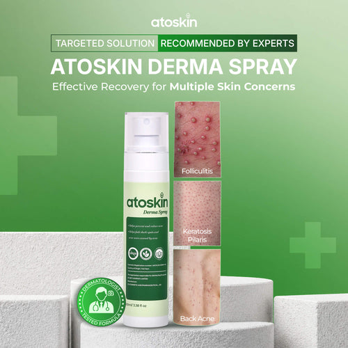 Atoskin Derma Spray – Advanced Folliculitis & Back Acne Treatment Spray (3.4 oz)