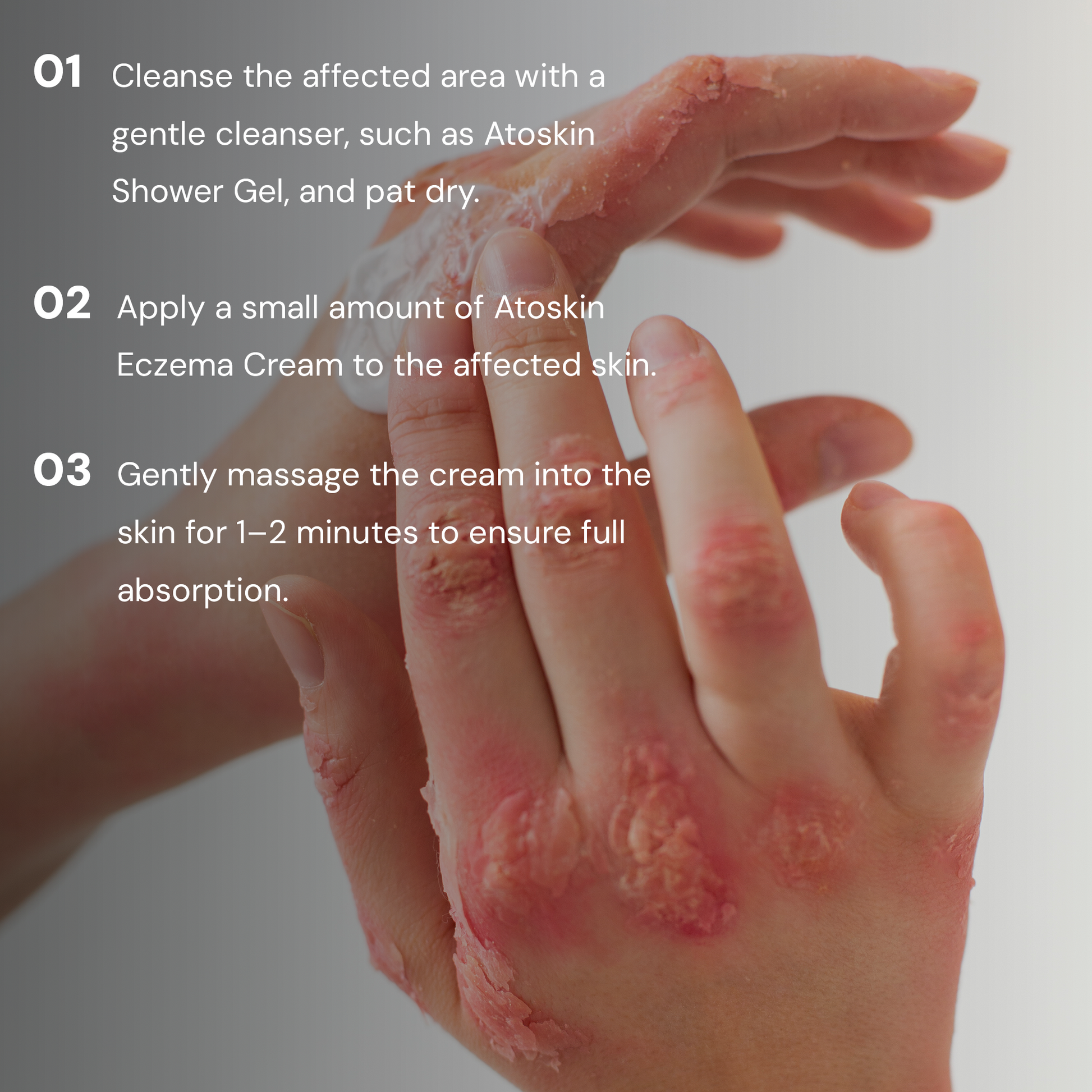Atoskin Eczema Cream (1.01 oz)