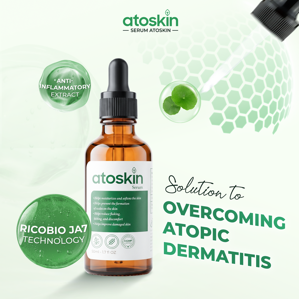 Atoskin Serum - for Eczema, Psoriasis, Itchy Skin and Dermatitis Irritation (1.7 fl oz)