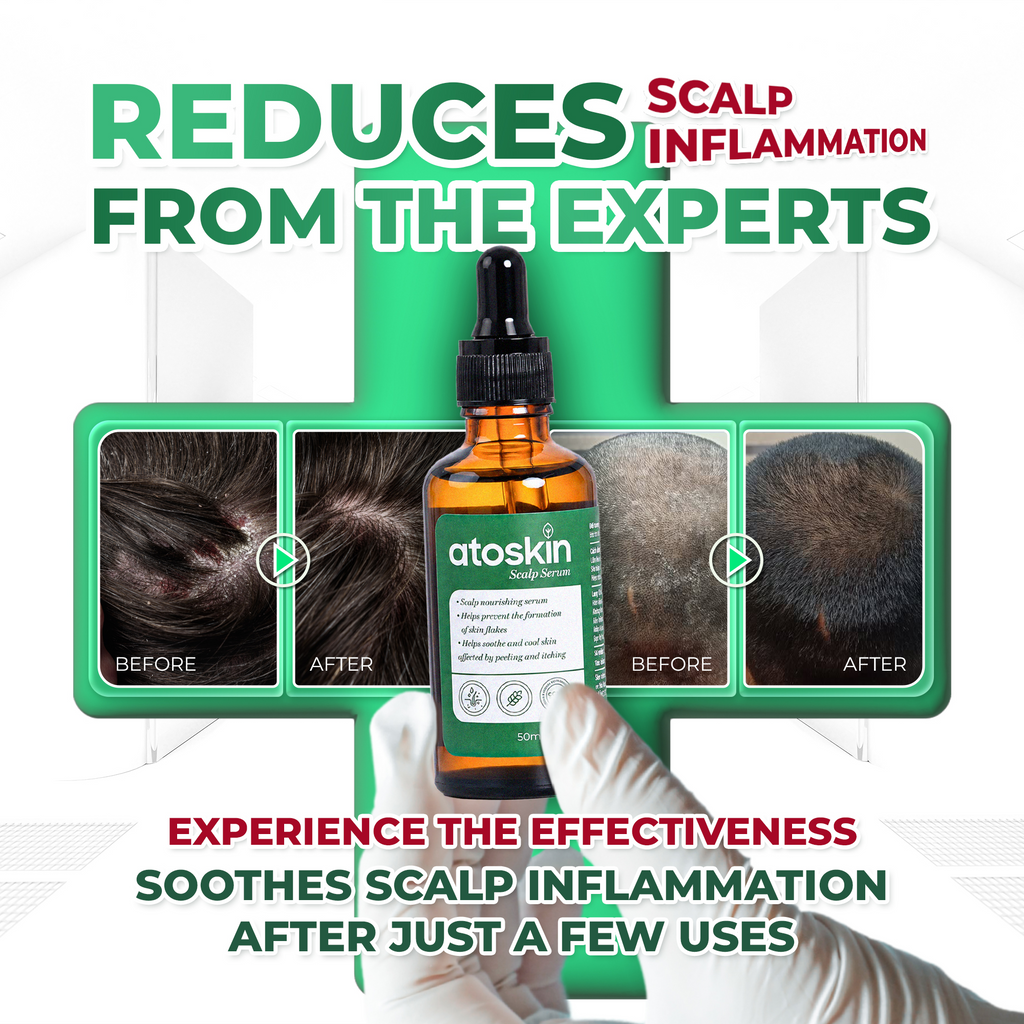 Atoskin Scalp Serum – Lightweight Leave-On Scalp Care (1.7 fl oz)