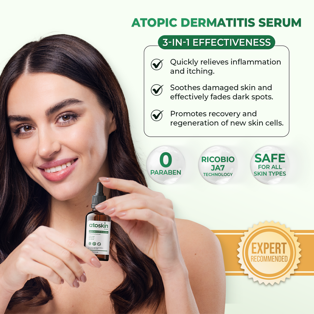 Atoskin Serum - for Eczema, Psoriasis, Itchy Skin and Dermatitis Irritation (1.7 fl oz)