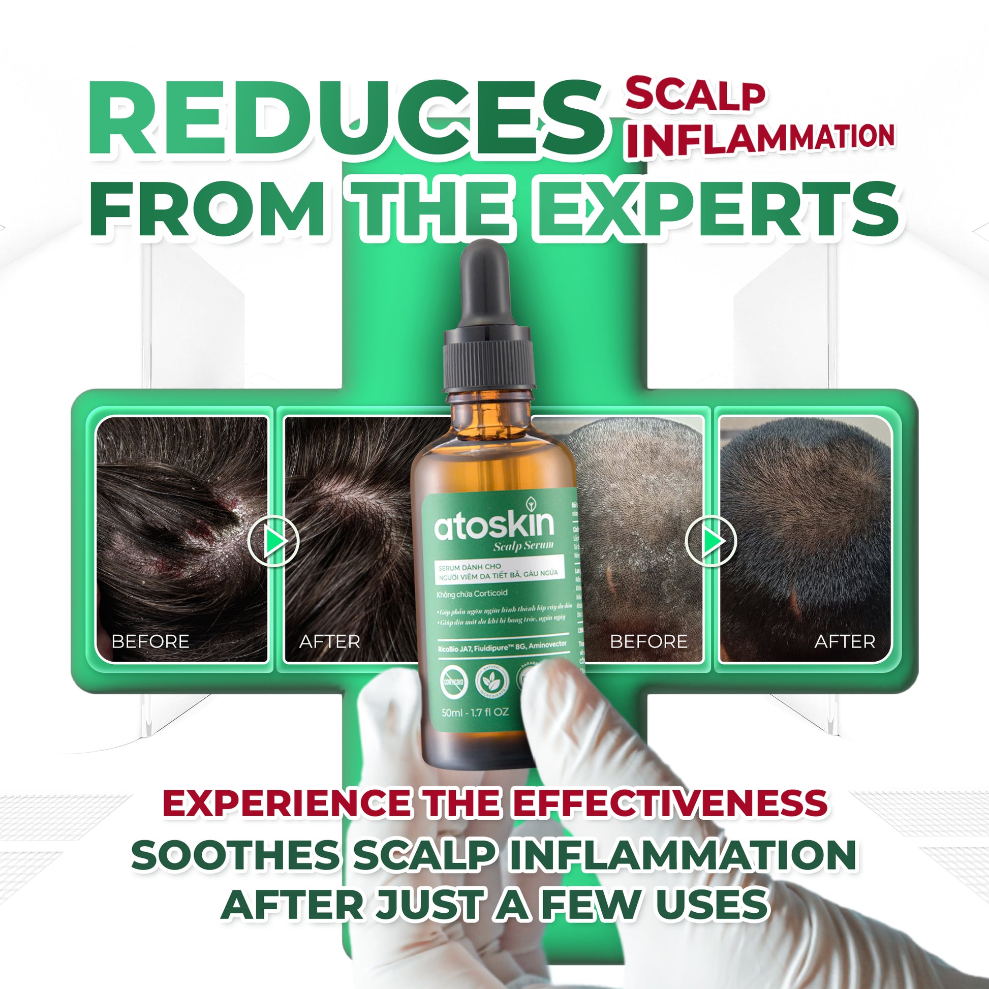 Atoskin Scalp Serum – Lightweight Leave-On Scalp Care with Botanical Extracts, Zinc PCA & Aquaxyl™ – Helps Improve Comfort & Oil Balance – Non-Greasy (1.7 fl oz)