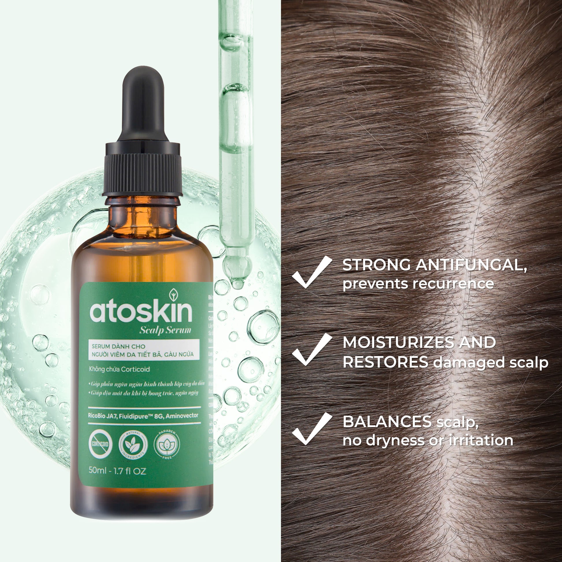 Atoskin Scalp Serum – Lightweight Leave-On Scalp Care with Botanical Extracts, Zinc PCA & Aquaxyl™ – Helps Improve Comfort & Oil Balance – Non-Greasy (1.7 fl oz)