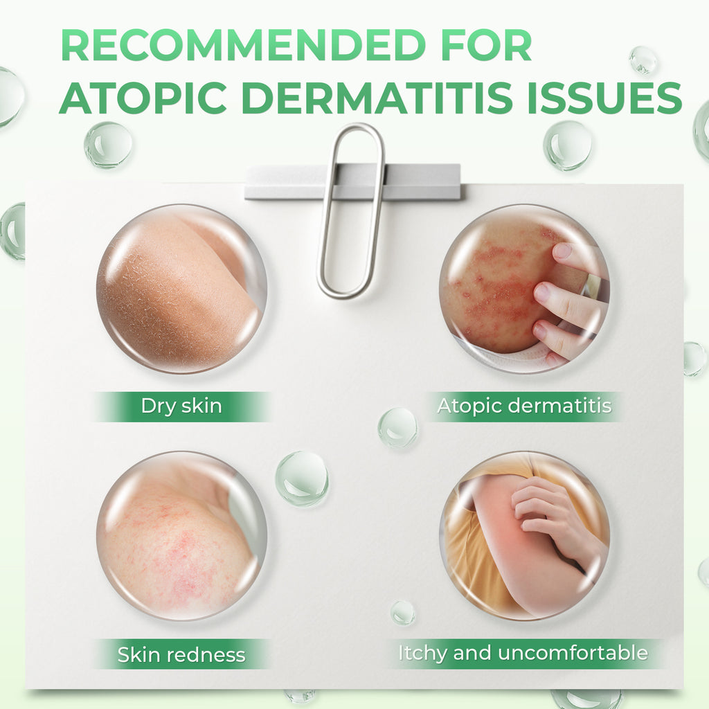 Atoskin – Specialized Body Wash for Eczema, Psoriasis & Dermatitis-Prone Skin