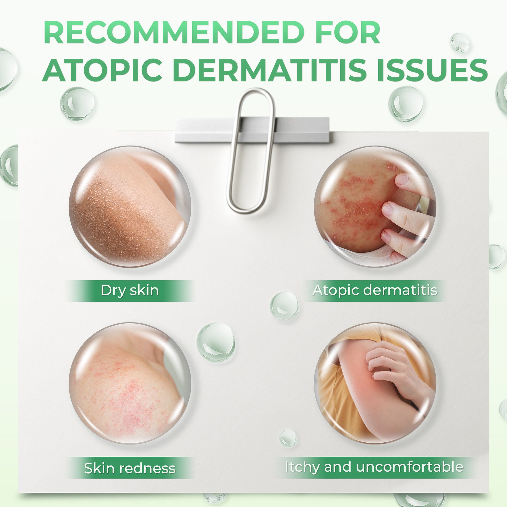 Atoskin – Specialized Body Wash for Eczema, Psoriasis & Dermatitis-Prone Skin