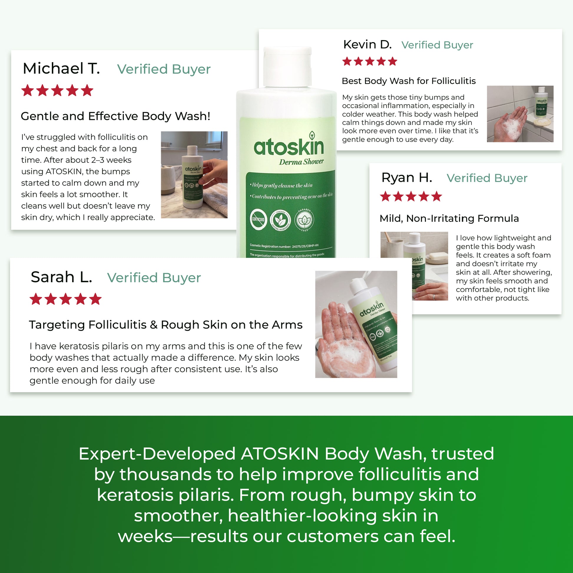 Atoskin Derma Shower – Advanced Folliculitis Body Wash (9.47 oz)
