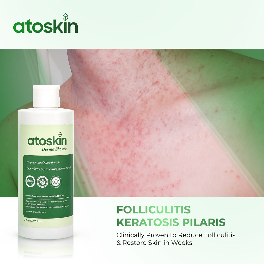 Atoskin Derma Shower – Advanced Folliculitis Body Wash (9.47 oz)