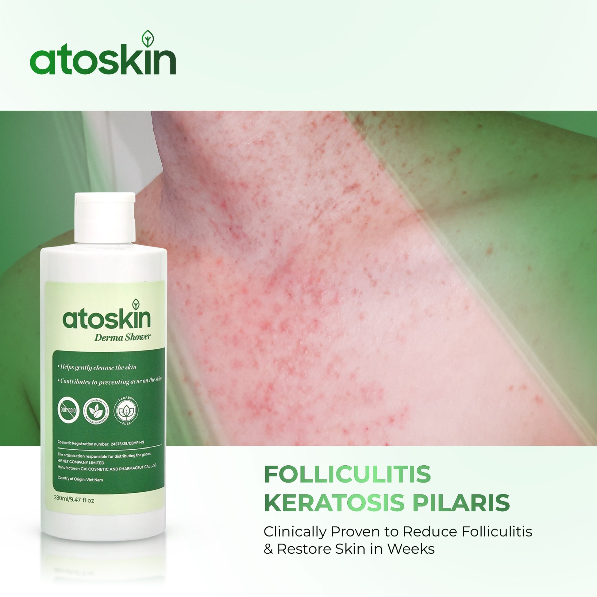 Atoskin Derma Shower – Advanced Folliculitis Body Wash (9.47 oz)